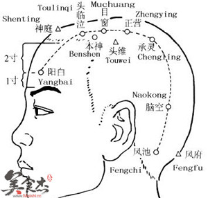 神经性头痛用针灸治疗